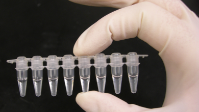 تحليل PCR الكاشف لفيروس كورونا الجديد